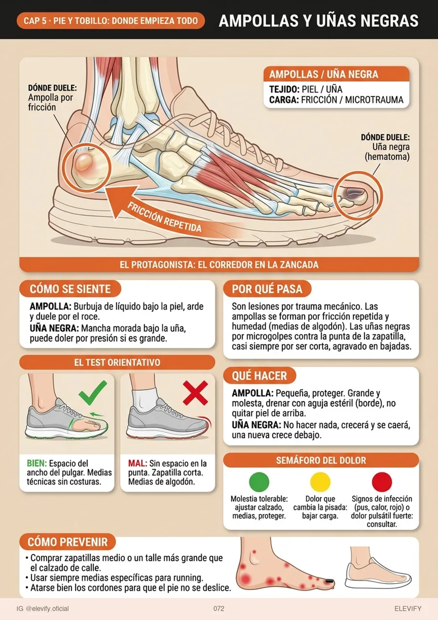 Fascitis plantar
